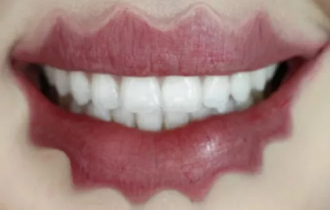 Labios ondulados, la perturbadora moda 