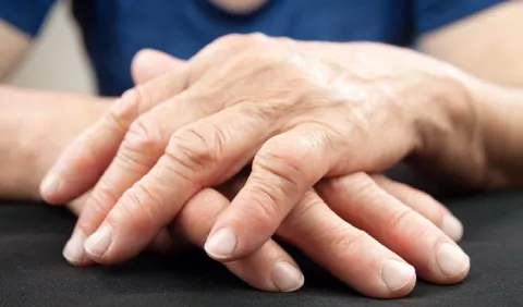 Artitris, daños permanentes en las articulaciones que debes prevenir