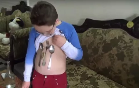 Niño atrae objetos de metal con su abdomen como si tuviese un imán