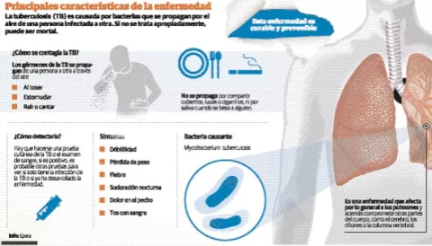 Tuberculosis, una enfermedad que amenaza la salud de los panameños