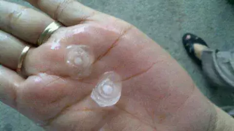 [VIDEO] Lluvia de granizo sorprende a residentes de Avenida Balboa