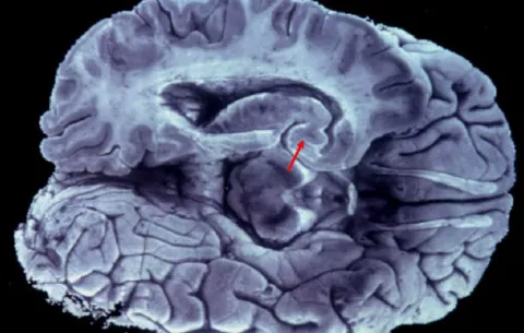 Científicos desarrollan nueva técnica que permite ver células en el cerebro