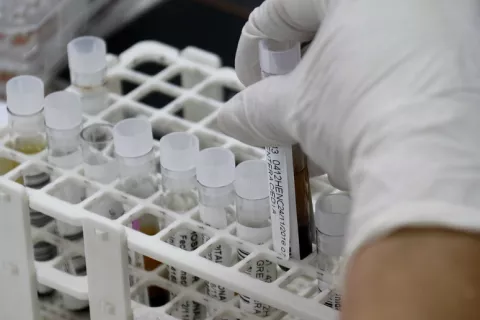 Desarrollan un medicamento contra el VIH en Argentina