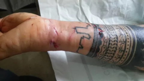 Monos aulladores atacan y muerden a turista canadiense en Isla Grande