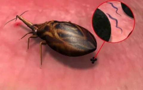Conoce más del brote epidemiológico de Chagas 