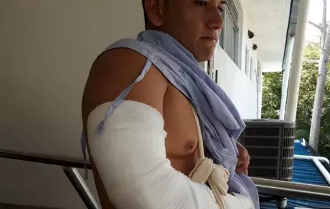 Denuncian  a dos policías en Chiriquí por fractura de un brazo a futbolista