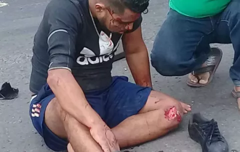 Dos heridos deja accidente de taxi en Buena Vista de Colón