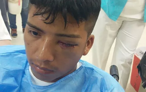 Joven indígena pierde un ojo tras manifestaciones con policías en San Juan