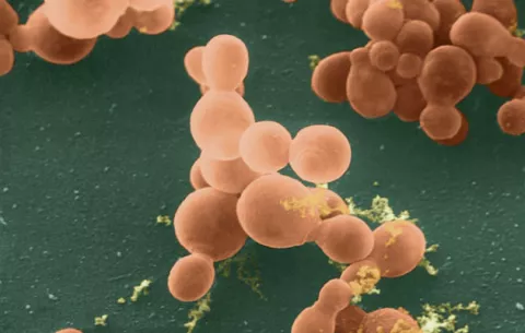 Nuevos estudios vinculan un hongo con cáncer