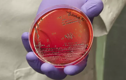 Científicos utilizan edición de genes contra las infecciones