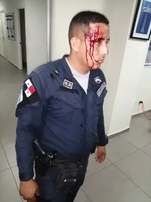El diputado Jairo 'Bolota' Salazar "rofea" e invita a pelear a un policía