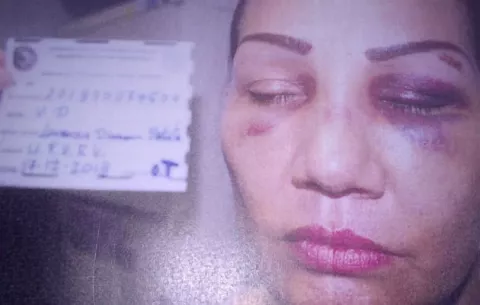 Mujer residente en Santiago asegura que de víctima la han pasado a victimaria 