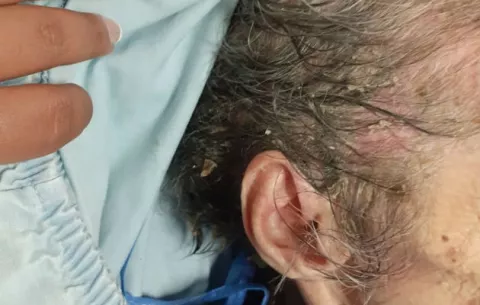 Adulta mayor que gritaba de dolor es atendida en Calobre, tenía gusanos y llagas en su cuerpo 
