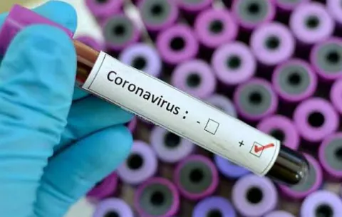 Coronavirus en Panamá: Se reportan 137 casos; diez permanecen en cuidados intensivos