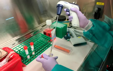 ¡Alarma en Chile! Confirman primer caso de coronavirus