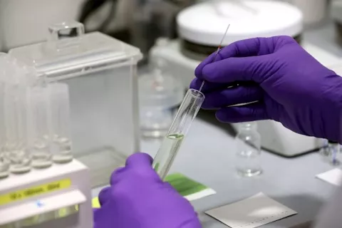 Coronavirus: Estados Unidos aprueba test de COVID-19  que ofrece resultados en menos de 15 minutos