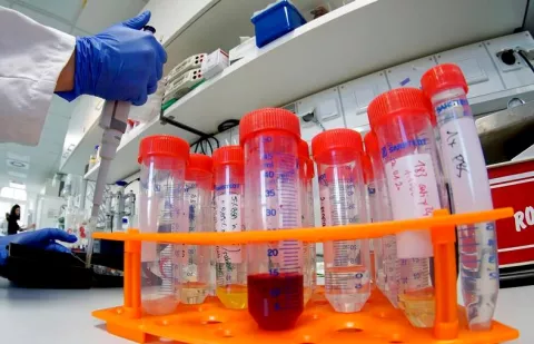 Italianos en Costa Rica esperan resultados de coronavirus (COVID-19) para ingresar a Panamá