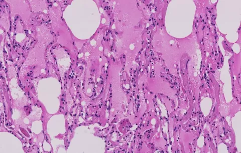 Esto hace el coronavirus al cuerpo humano