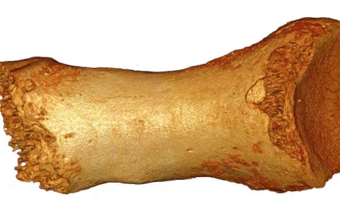 ADN arroja que los humanos salieron de África mucho antes de lo que se creía