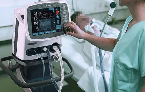  Comité Técnico Asesor revaluará necesidad de ventiladores para atender a pacientes con COVID-19