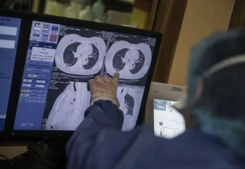Francia investiga si la nicotina es capaz de frenar el coronavirus