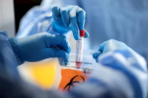 Una científica escocesa identificó el primer coronavirus humano en 1964