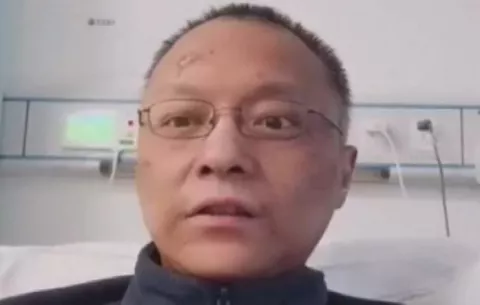 Problema hepático por COVID-19 causa ennegrecimiento a dos médicos chinos