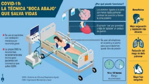 Colocar boca abajo a los pacientes graves, la técnica contra el COVID-19 que ayuda a salvar vidas