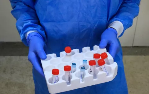 ¿Por qué no es necesario repetir pruebas de PCR a los recuperados clínicos?