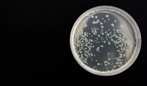 Descubren por accidente bacteria que come metal