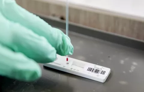 Vacuna española contra el coronavirus estaría lista en el 2021
