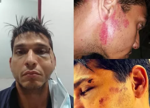 Taxista: un policía me aplastó la cabeza sobre el pavimento y perdí el conocimiento