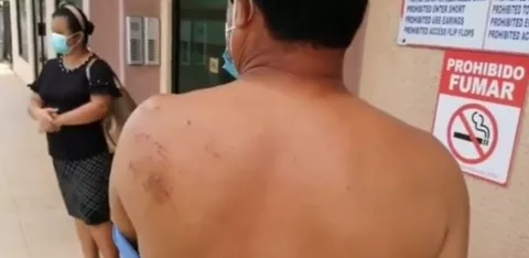 Le llueven golpes y patadas a pastor evangélico en Chiriquí