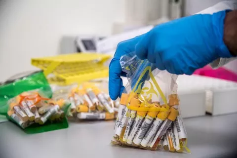 Descubren mecanismo que provoca la respuesta inflamatoria en niños con COVID-19