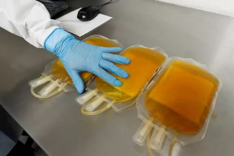 Terapia con plasma de convalecientes puede disminuir la gravedad de la COVID-19