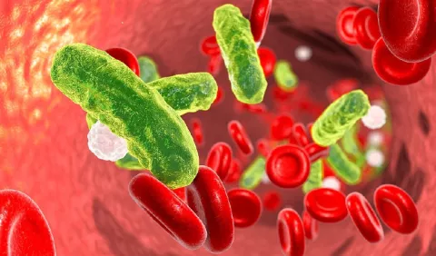 Hoy es el Día Mundial de la Sepsis, te contamos todo sobre esta enfermedad