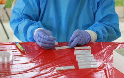 Pruebas de antígeno serían más útiles para cortar la cadena de transmisión del coronavirus