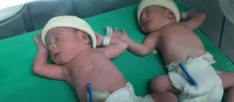 Nacen primeros niños producto del Programa de Fertilización in Vitro para parejas de escasos recursos en Panamá