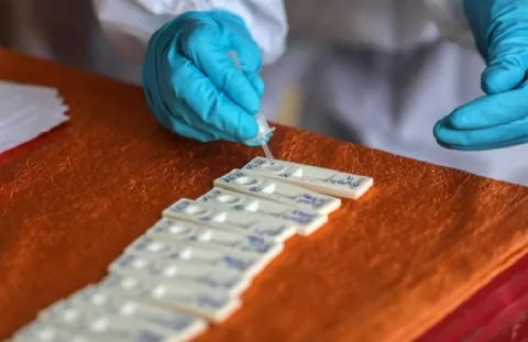 Desarrollan en Japón un test de anticuerpos de la COVID-19 usando gusanos de seda