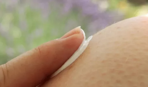 ¿Cómo tener una piel saludable?
