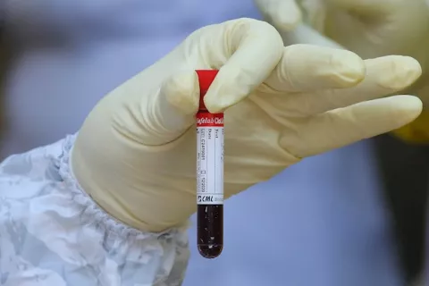Sangre tipo O podría ofrecer cierta protección contra la infección por COVID-19