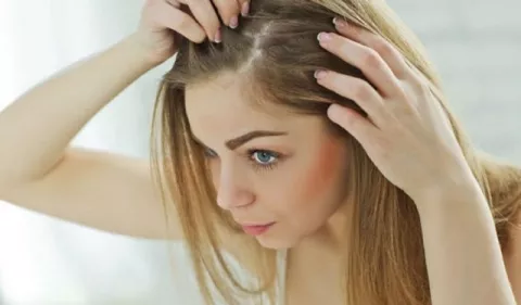 Factores que agravan la dermatitis seborreica