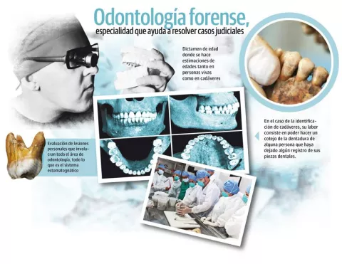Dentadura, testigo de la  vida y la  muerte dentro de una investigación judicial