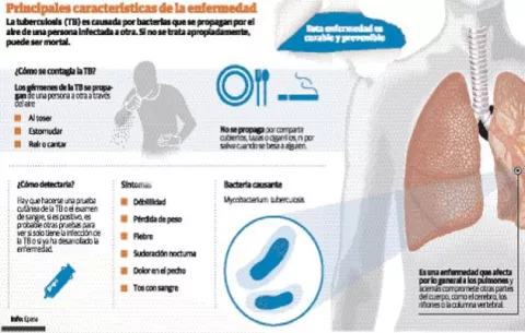 Aumentan casos de tuberculosis en Latinoamérica en medio de pandemia de COVID-19, por ello presentan proyecto para combatir esta enfermedad 