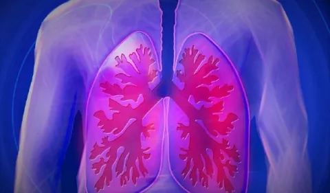 Válvula pulmonar, una nueva opción para tratar a los pacientes con EPOC
