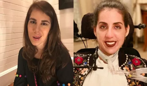 'Bold Beauty Project': Exhibición virtual que narra historias personales e inspiracionales de siete mujeres con discapacidades