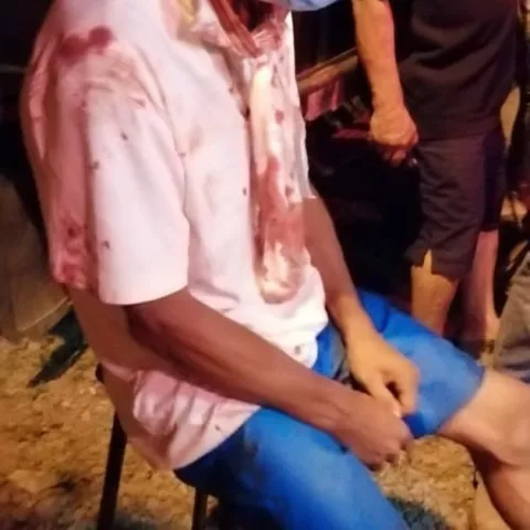 En Bugaba delincuentes golpean y amordazan a capataz de finca y se llevan la planilla