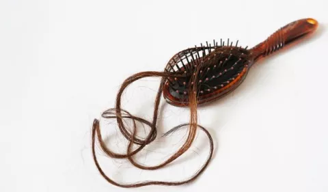 Causas de la caída del cabello: Mitos y realidades