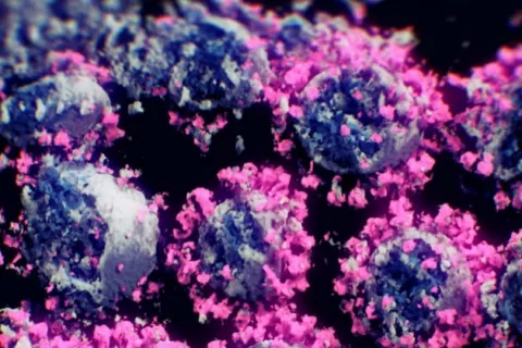 ¡Atención! Detectan una nueva variante del coronavirus en el sur de California