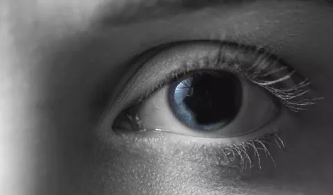 Aniridia: ¿Cómo es vivir sin iris?